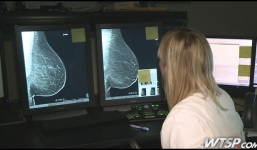 Phát hiện ung thư vú sớm nhất bằng cách chụp X-quang 3D