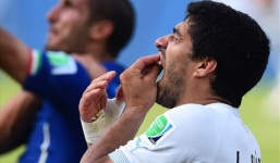 Bệnh cắn người của Suarez chữa được nhưng rất mất thời gian