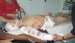 Bị chém suýt chết vì lấy điện thoại trêu chồng của người tình