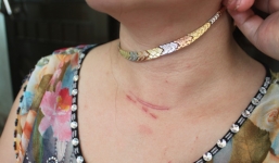 Vờ mang gà đi bán, 4 thanh niên táo tợn cướp dây chuyền