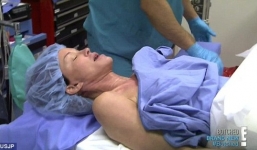 Ảnh phẫu thuật ngực của siêu mẫu Janice Dickinson