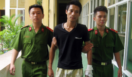 Bị 'cắm sừng', ca sĩ phòng trà tạt axit vợ dã man