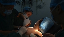 Cận cảnh quá trình nâng ngực đau đớn của mẫu nội y 9X