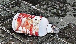 Vợ kêu chồng cũ tạt axít chồng “hờ” chấn động miền Trung