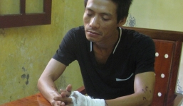 Ca sĩ phòng trà tạt axit vợ vì… nốt ruồi “nhiều đàn ông”