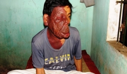 Người có gương mặt quái dị lấy tay che mặt bán vé số