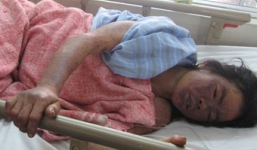 Rùng mình ảnh tác hại khủng khiếp vì ăn tiết canh