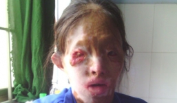 Cuộc đời giông bão của người phụ nữ bạo bệnh bị chồng bỏ rơi vì tội… không biết đẻ!