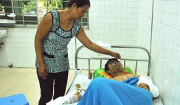 Nam sinh bị người lạ mặt tạt axit trước ngày thi đại học