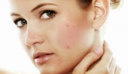 Đoán bệnh hiểm nghèo qua dấu hiệu của làn da