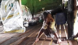 Bé gái 4 tuổi bị mẹ xích chân vào cột nhà suốt 2 năm