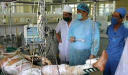 Máy bay rơi ở Hòa Lạc: 'Cần cắt bỏ hoại tử bỏng sớm cho 3 chiến sỹ bị thương'