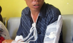 Ngăn đánh nhau, bị chém tới tấp đứt gân hai cánh tay