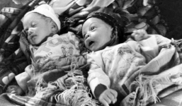 Sản phụ sinh 2 con cách nhau 1 tháng: Chuyên gia nói gì? 