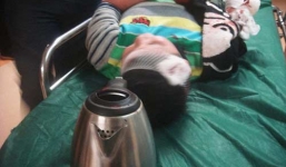 Bé 8 tuổi bị bố dượng cắt tay ném vào nước sôi luộc chín