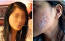 Cô gái xinh đẹp tố bị thẩm mỹ viện biến thành 'gương mặt quỷ'