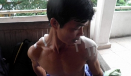 Mâu thuẫn trong quán karaoke, côn đồ chém người trọng thương