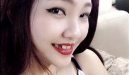 Cô gái xinh đẹp gãy răng vì cắn tên cướp được mời đóng clip ca nhạc