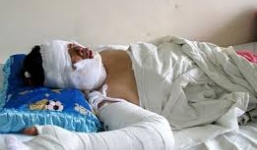 Con gái bị chụp ảnh, tạt nồi nước sôi vào mặt bạn nhậu