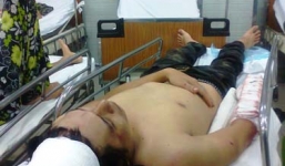 Chém vào đầu khiến bạn gục tại chỗ vì bị bắt nạt