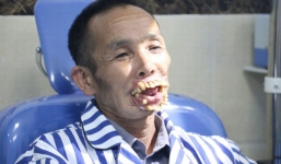 Người đàn ông bị chó sói tấn công sắp được phẫu thuật tái tạo khuôn mặt