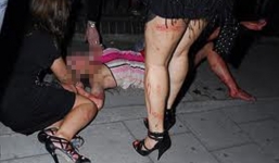 Nhét ớt vào vùng kín tình địch, bi kịch “ông ăn chả, bà ăn nem”?