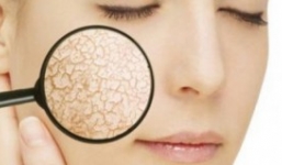 5 dấu hiệu của làn da chứng minh bạn bị bệnh