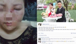Cộng đồng mạng bức xúc chồng đánh vợ sưng tím mặt đăng chiến tích lên Facebook