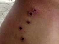 Bị đạn hoa cải găm chi chít vào người vì chưa kịp trả tiền