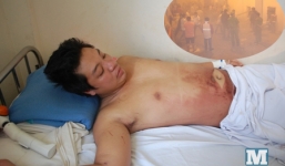 Sức khỏe công nhân kẹt 5 đêm trong kho lạnh âm 20 độ đã ổn định