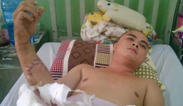 Côn đồ truy sát trong quán thịt chó, 5 người trọng thương