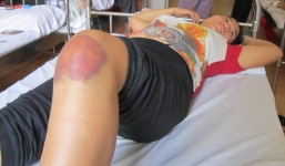 Kinh hoàng một phụ nữ mang thai bị giang hồ truy sát tại Hà Nội