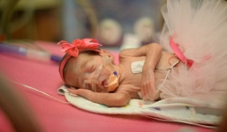 Bộ ảnh về trẻ sinh non của bà mẹ mất con gây xúc động