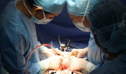 Bị hoại tử ruột vì trót nuốt 2 chiếc răng giả