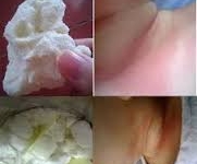 Sữa Physiolac vón cục, gây mẩn đỏ: Cục VSATTP vào cuộc