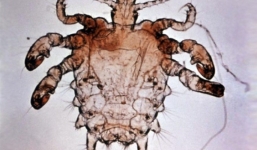 Rận mu bất ngờ tái xuất tại Hà Nội