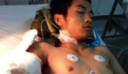 Chàng trai bị chém rơi cánh tay hoảng loạn ở bệnh viện