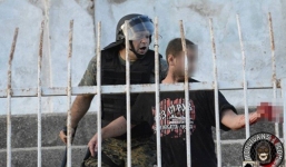 Cổ động viên đứt lìa bàn tay vì đụng độ với cảnh sát