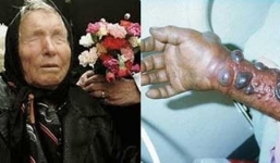 Dịch Ebola và lời tiên tri đáng sợ của Vanga về dịch bệnh năm 2014