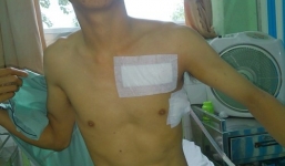 Đâm thủng người hàng xóm vì hát karaoke tại nhà