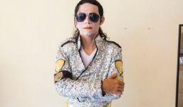 Chi tiền 'khủng' tiêm axit lên mặt, người đàn ông biến thành...Michael Jackson