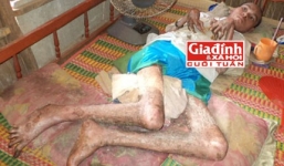 Người đàn ông 'hóa rắn' sau khi ăn rắn độc