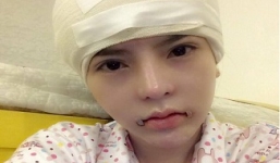 Vân Tokyo tiếp tục tung ảnh quá trình thẩm mỹ 