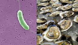 Cảnh báo nguy hiểm: Vi khuẩn ăn thịt người khi đi tắm biển