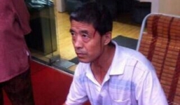 Đang đi đường, bị con dao 'từ trời rơi xuống' cắm thẳng vào đầu