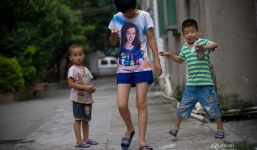 Cuộc sống thường ngày của cô gái có bộ phận sinh dục kép cả nam và nữ