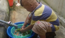 Cuộc sống của cháu bé bị cha đốt 3 năm trước