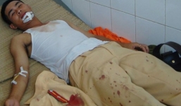 Thiếu úy cảnh sát bị chém trúng mặt vẫn dũng cảm bắt côn đồ