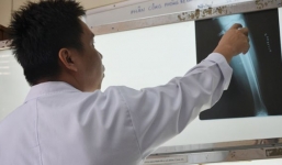 Chịu cực hình kéo xương để có chân dài tại TP.HCM