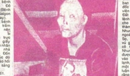 Phận đời cay đắng của vũ nữ bị tạt axít nổi tiếng nhất Sài Gòn